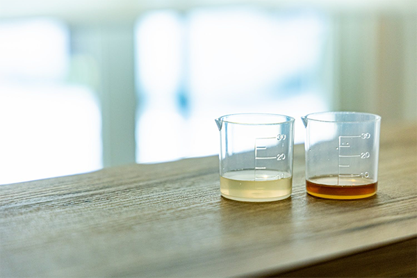 薄毛ケア専門美容室 シャン美容室施術の流れ