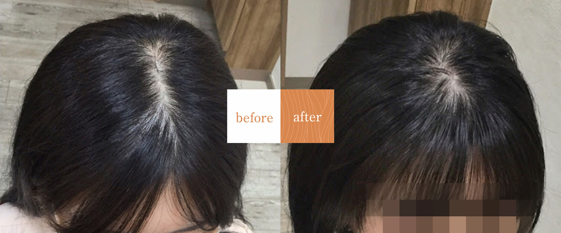 薄毛ケア専門サロン シャン美容室改善事例